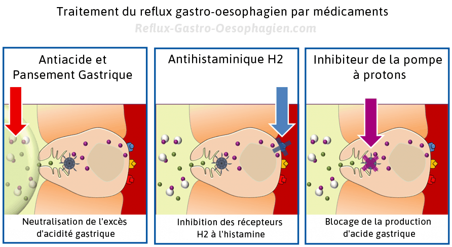 Coussin Anti-Reflux Et Rehausseur Pour Lit Dolci Sogni - Oreiller Triangulaire 35x30x6cm - Pour Reflux Gastro-Œsophagien, Dormir Incliné, Lecture - Fabriqué En Italie