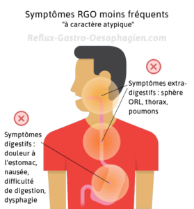 Symptomes RGO