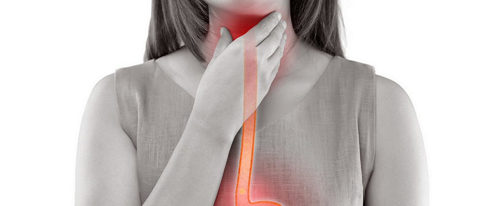Reflux gastrique et mal de gorge