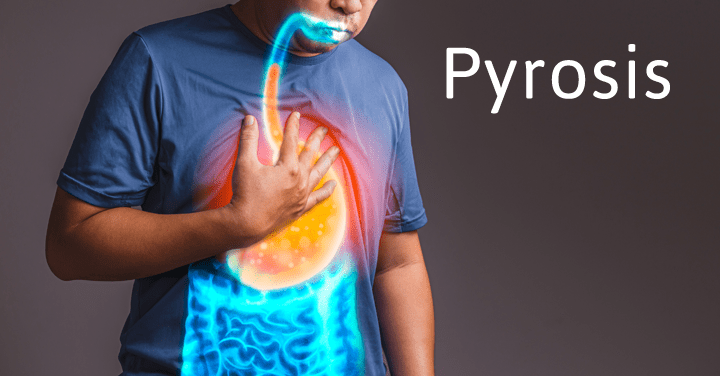 pyrosis