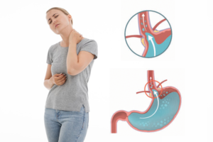 reflux gastrique et fatigue