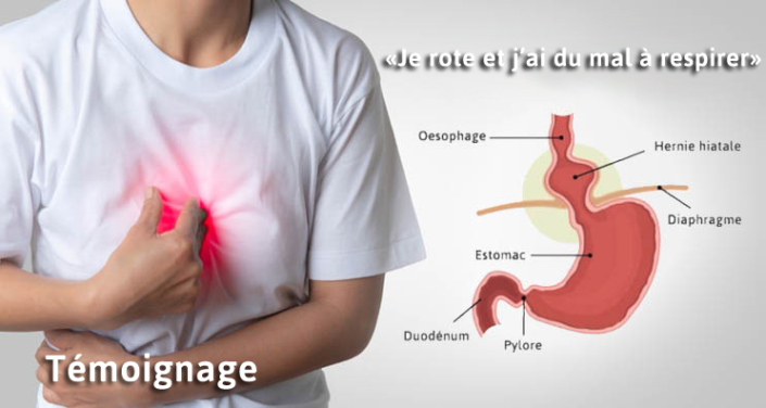 Je rote beaucoup et j'ai du mal à respirer | Témoignage de Denise