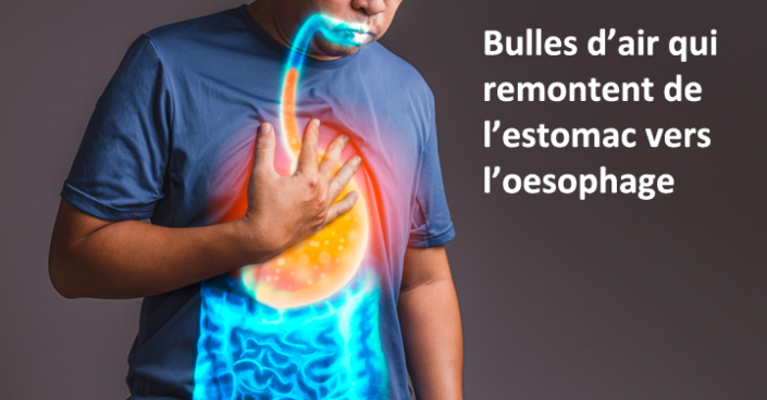 Comment Faire Pour Avoir Un Maximum D'air Dans L Oesophage