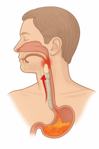 raclement de gorge et glaires