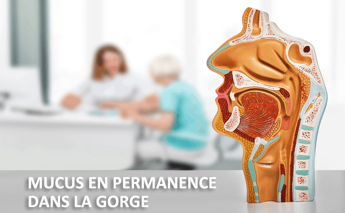 Mucus gorge en permanence